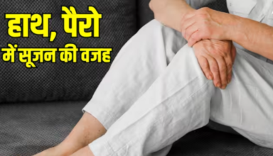 Swelling: क्या है हाथ और पैरों में सूजन का कारण? जाने क्या हैं इसका कारण और बचाव?