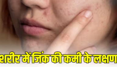 Zinc Deficiency Symptoms in Skin: त्वचा में Zinc की कमी के कारण दिखाई देते हैं ये लक्षण, कमजोर हो सकती है प्रतिरक्षा